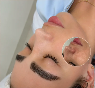 Facial Express Glow en Franceska Beltrán Studio Medellín