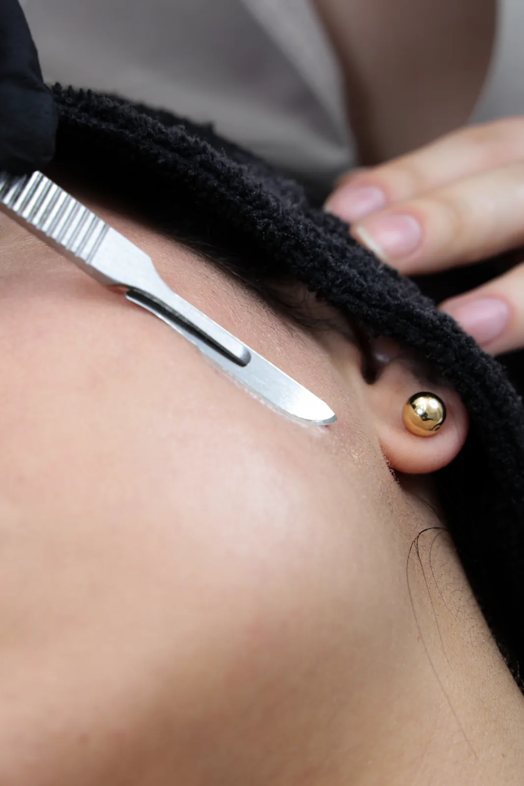 Porcelanización + Dermaplaning en Franceska Beltrán Studio Medellín